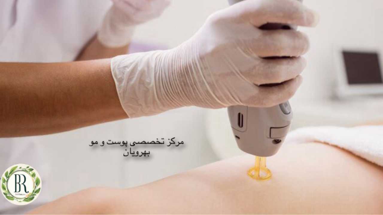 مرکز لیزر موهای زائد کرج