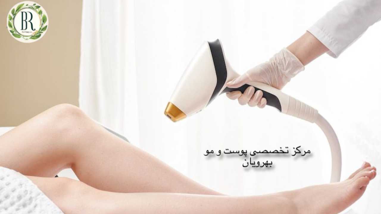 لیزر موهای زائد در کرج