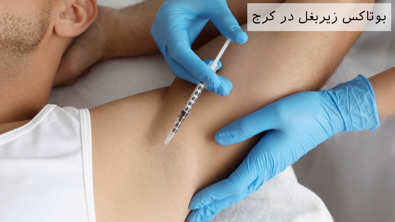 بوتاکس زیربغل کرج