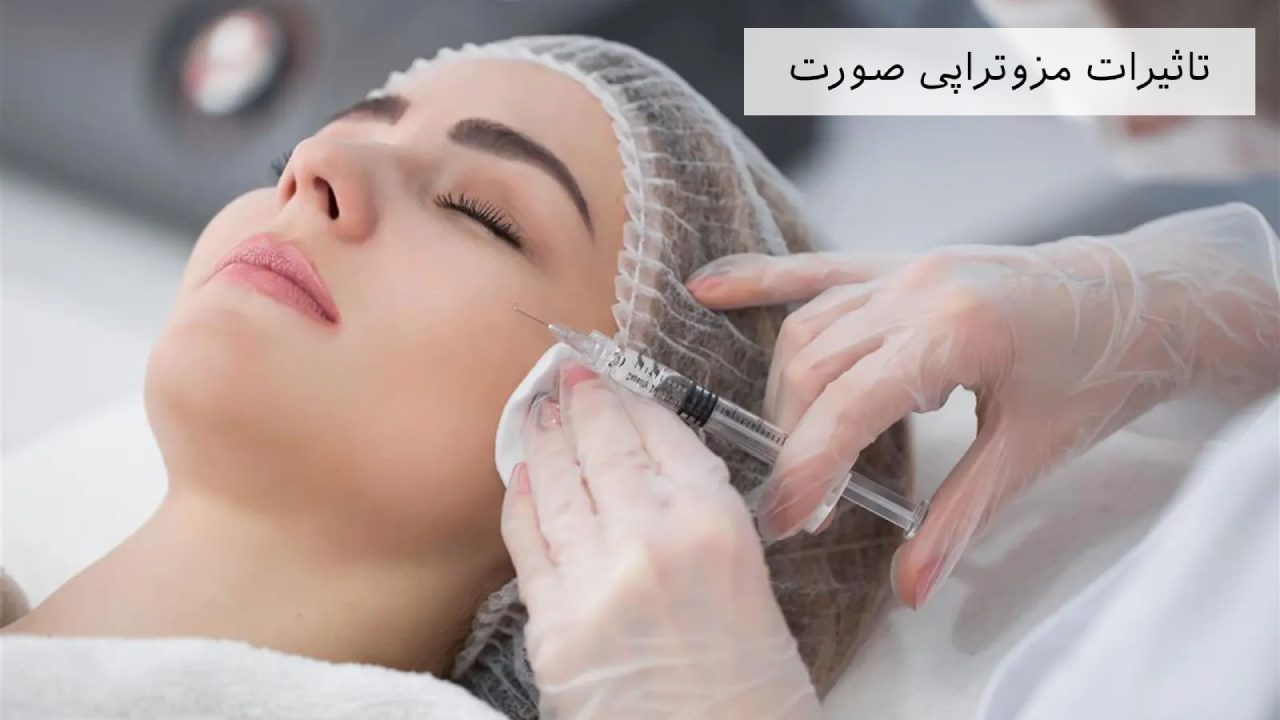 تاثیر مزوتراپی صورت