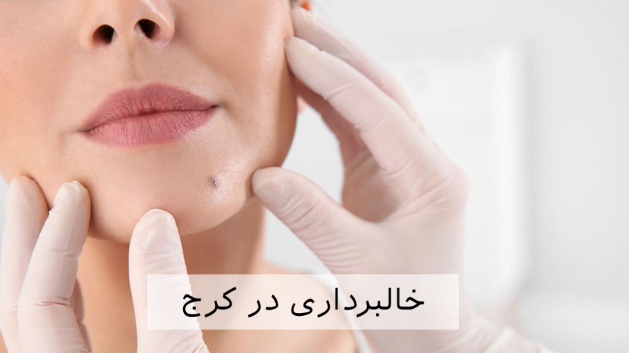 خالبرداری در کرج