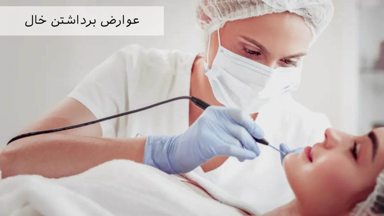 عوارض برداشتن خال