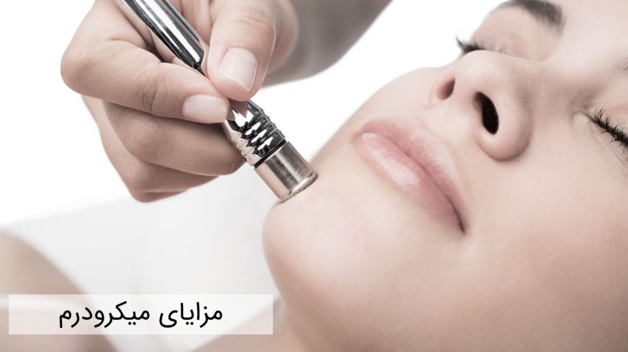 مزایای میکرودرم