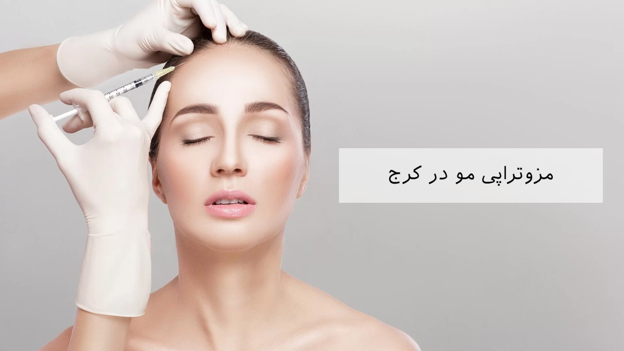 مزوتراپی مو در کرج