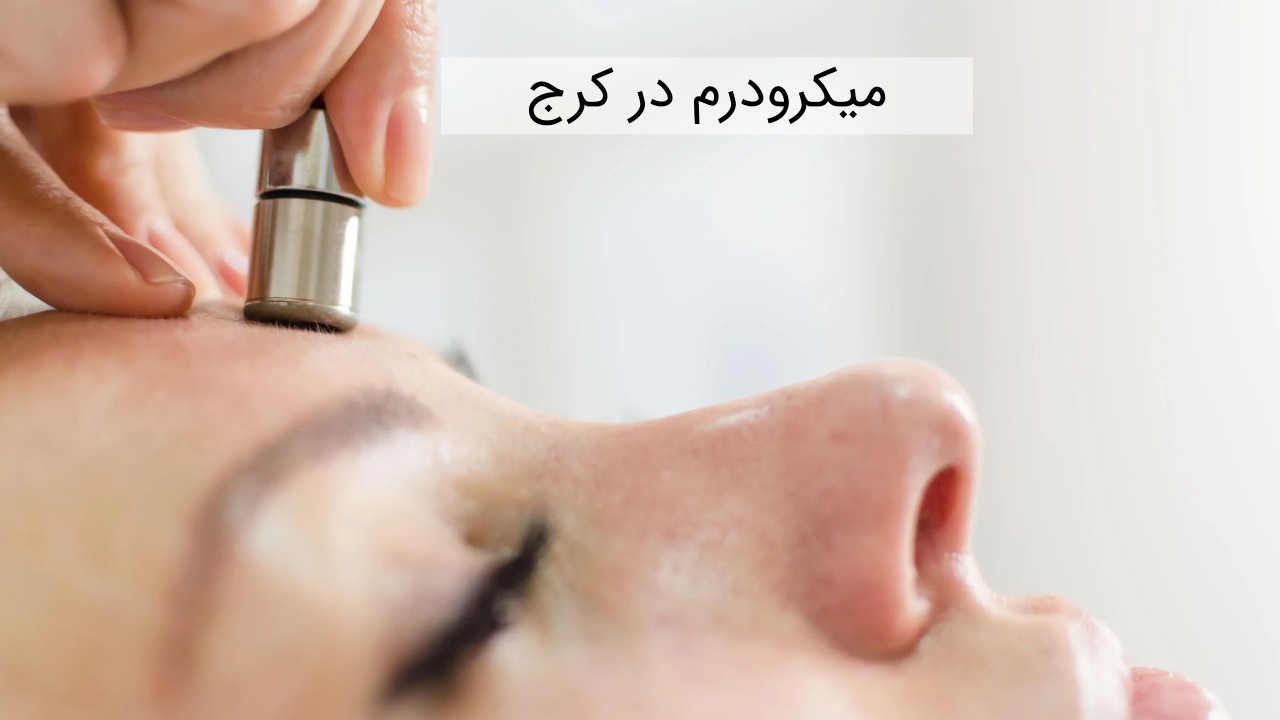 میکرودرم در کرج