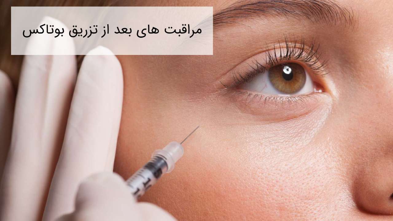 مراقبت های بعد از تزریق بوتاکس