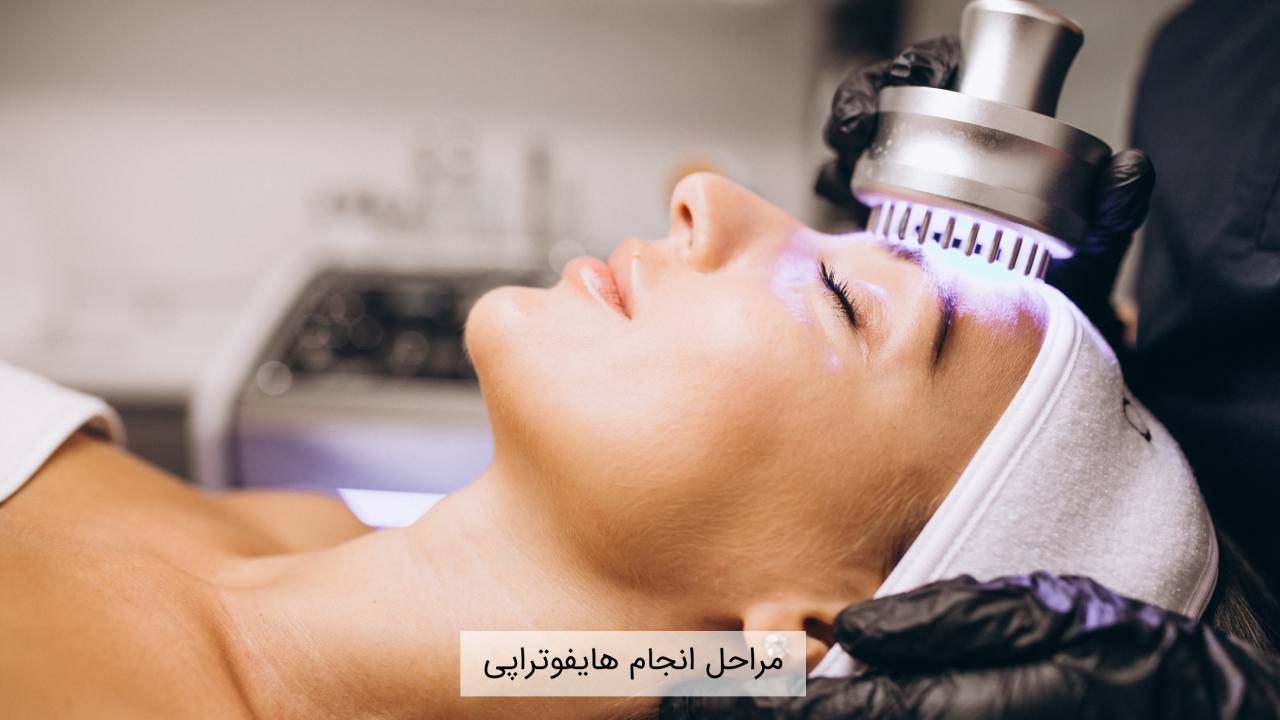 مراحل انجام هایفوتراپی در کرج