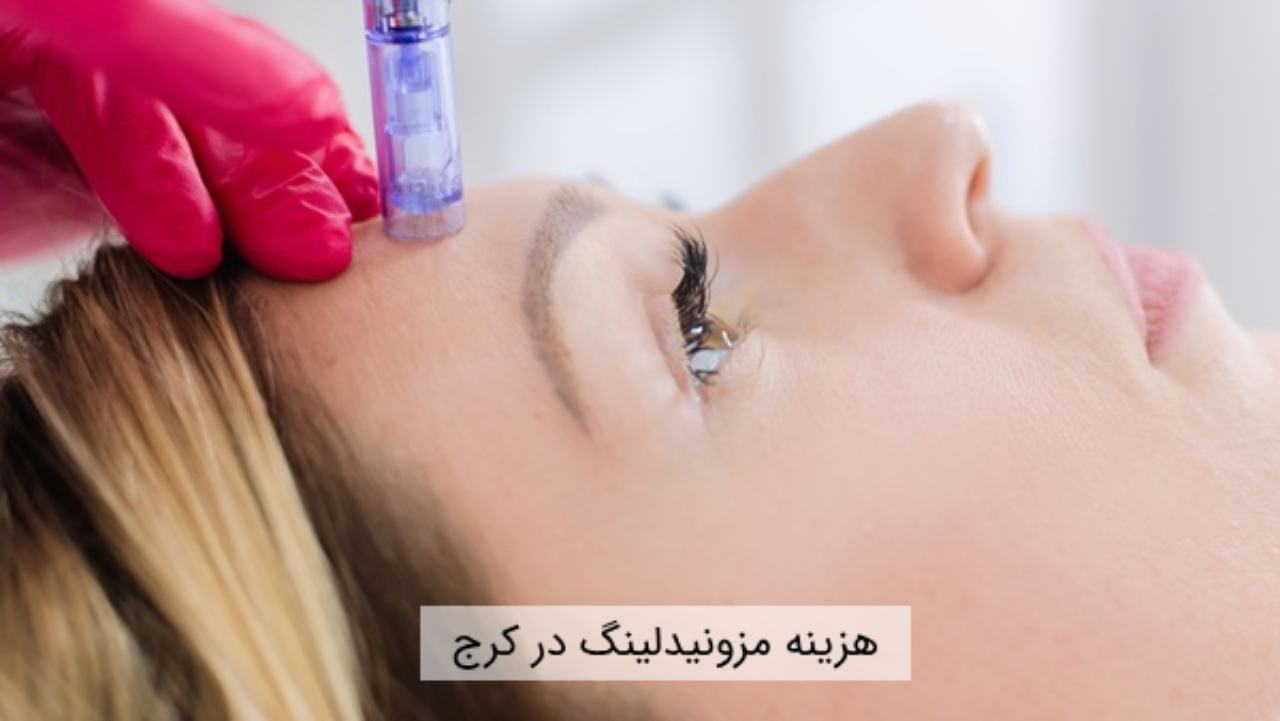 هزینه مزونیدلینگ در کرج