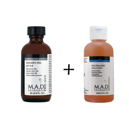 اسید جسنر ام ای دی M.A.D به همراه محلول خنثی کننده_67bc6ff6cc786.jpeg